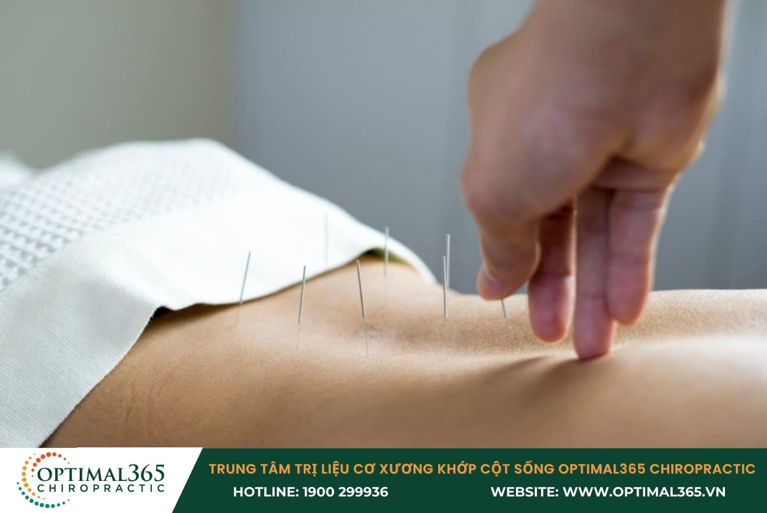 8 Phương pháp điều trị thoát vị đĩa đệm bằng Đông Y