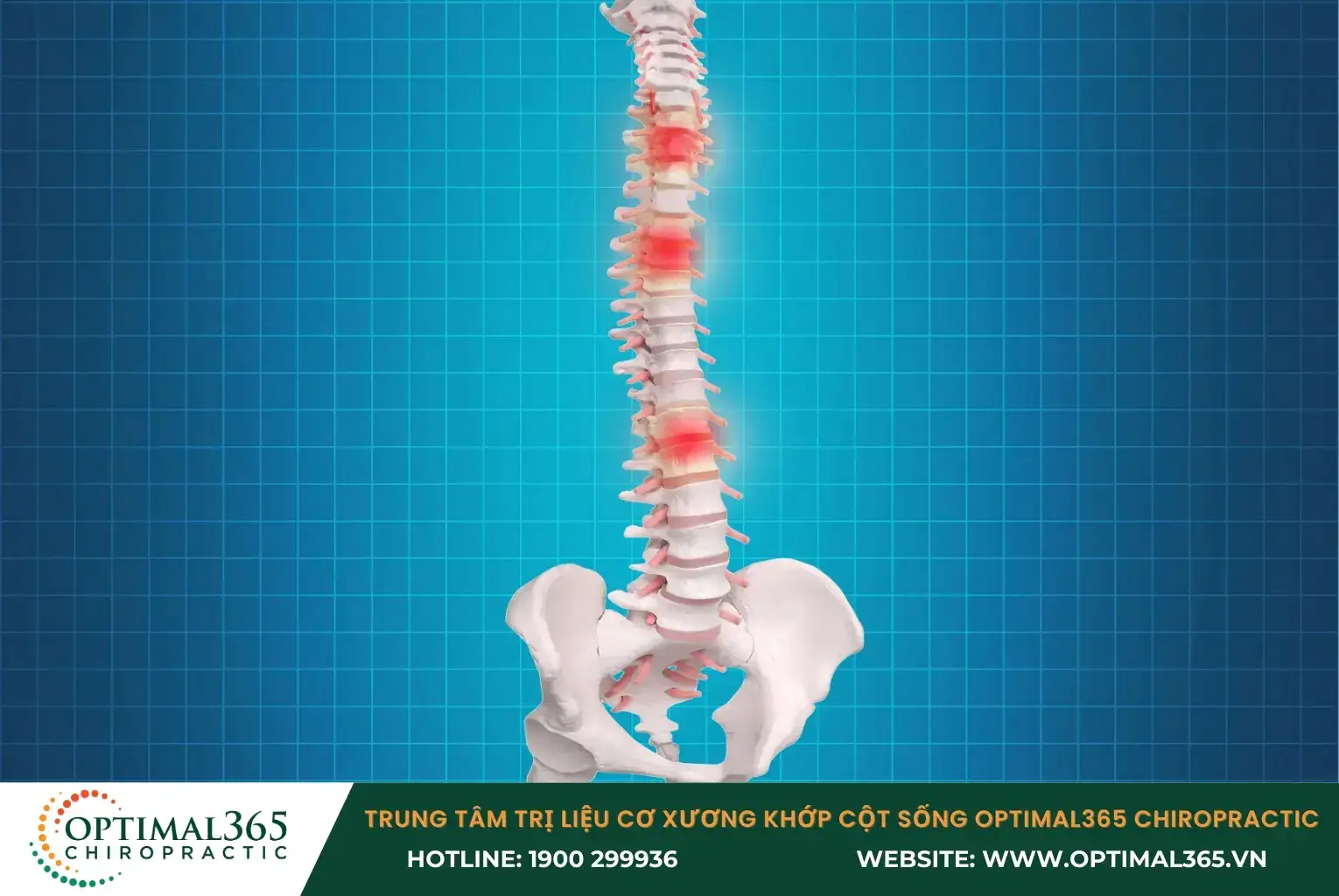 Đau lưng là một biểu hiện phổ biến hàng đầu của các bệnh lý cột sống