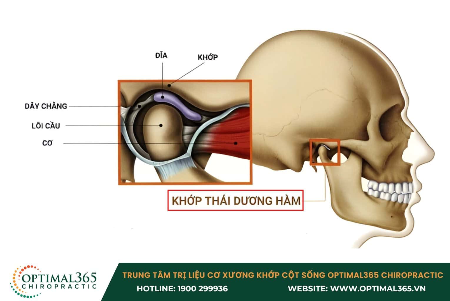 Rối loạn khớp thái dương hàm (TMJ) là bệnh gì?