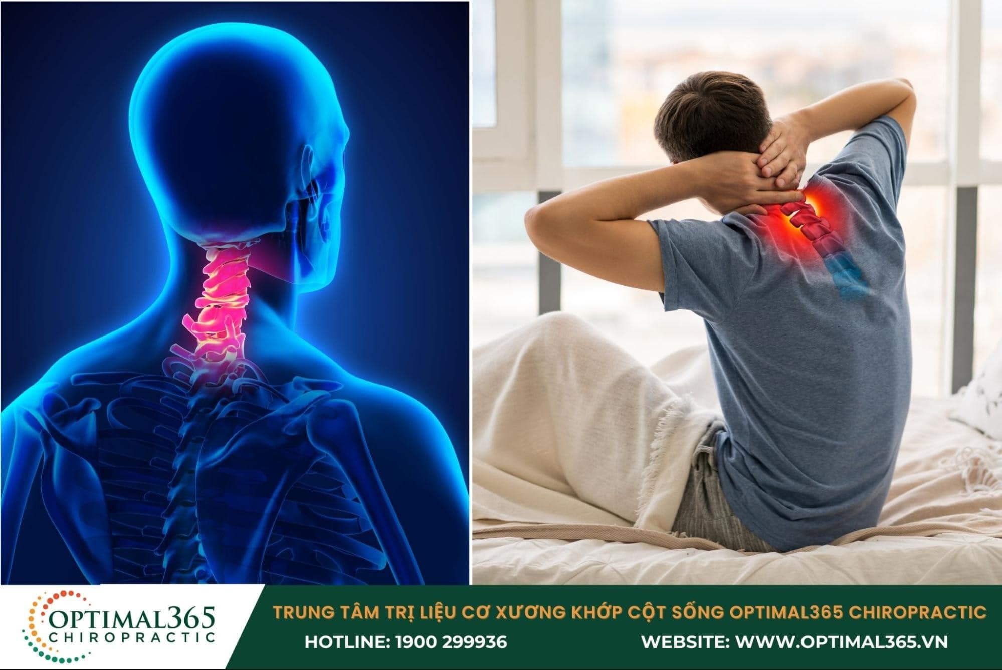 Vì sao thoái hóa đốt sống cổ gây đau đầu?