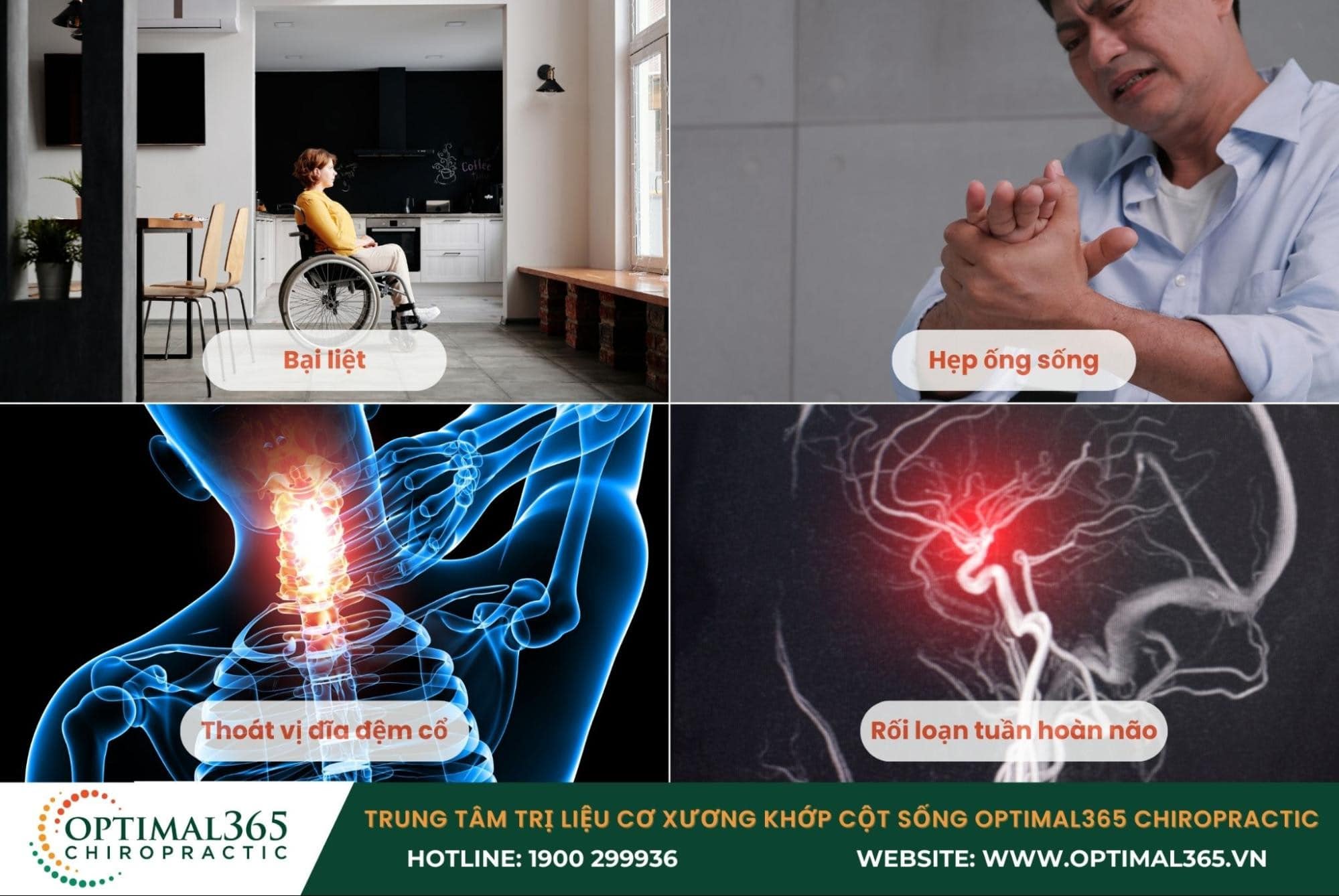 Thoái hóa đốt sống cổ gây đau đầu có nguy hiểm không?