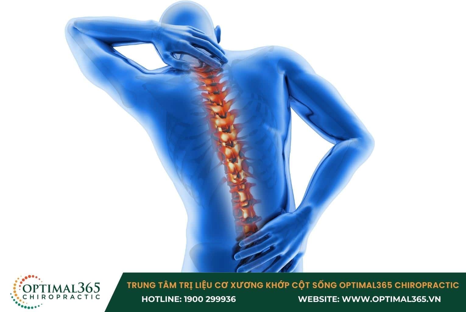 Gai cột sống là gì?