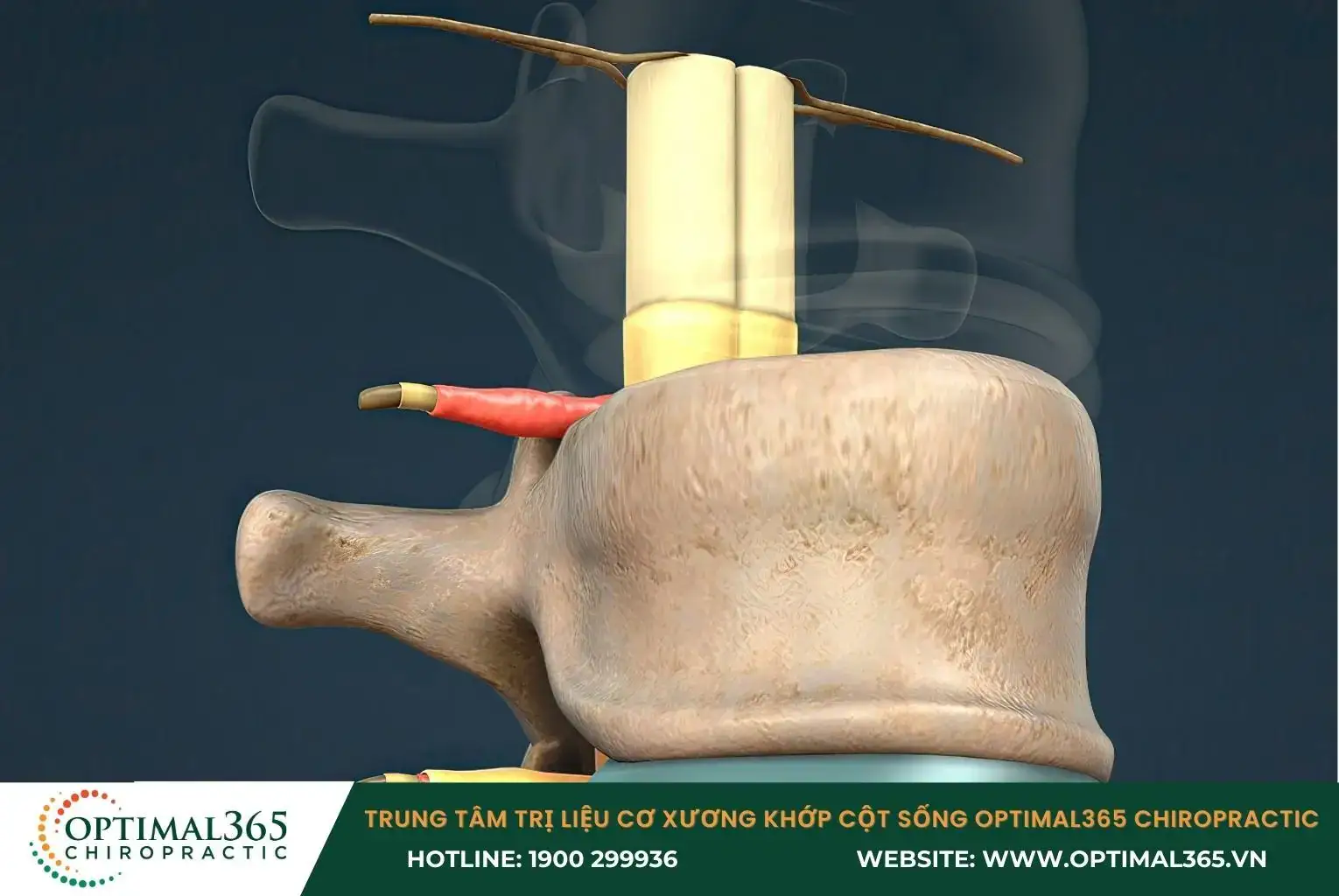 Tổn thương tủy sống có thể do té ngã, tai nạn giao thông, tai nạn công việc