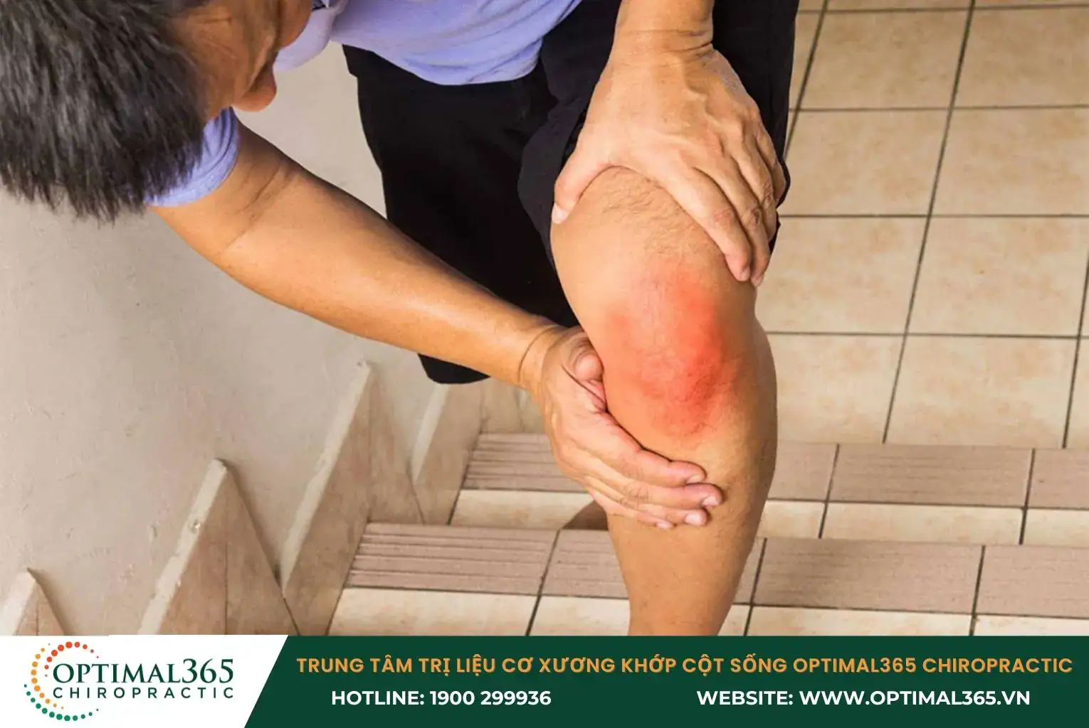 Bong gân đầu gối