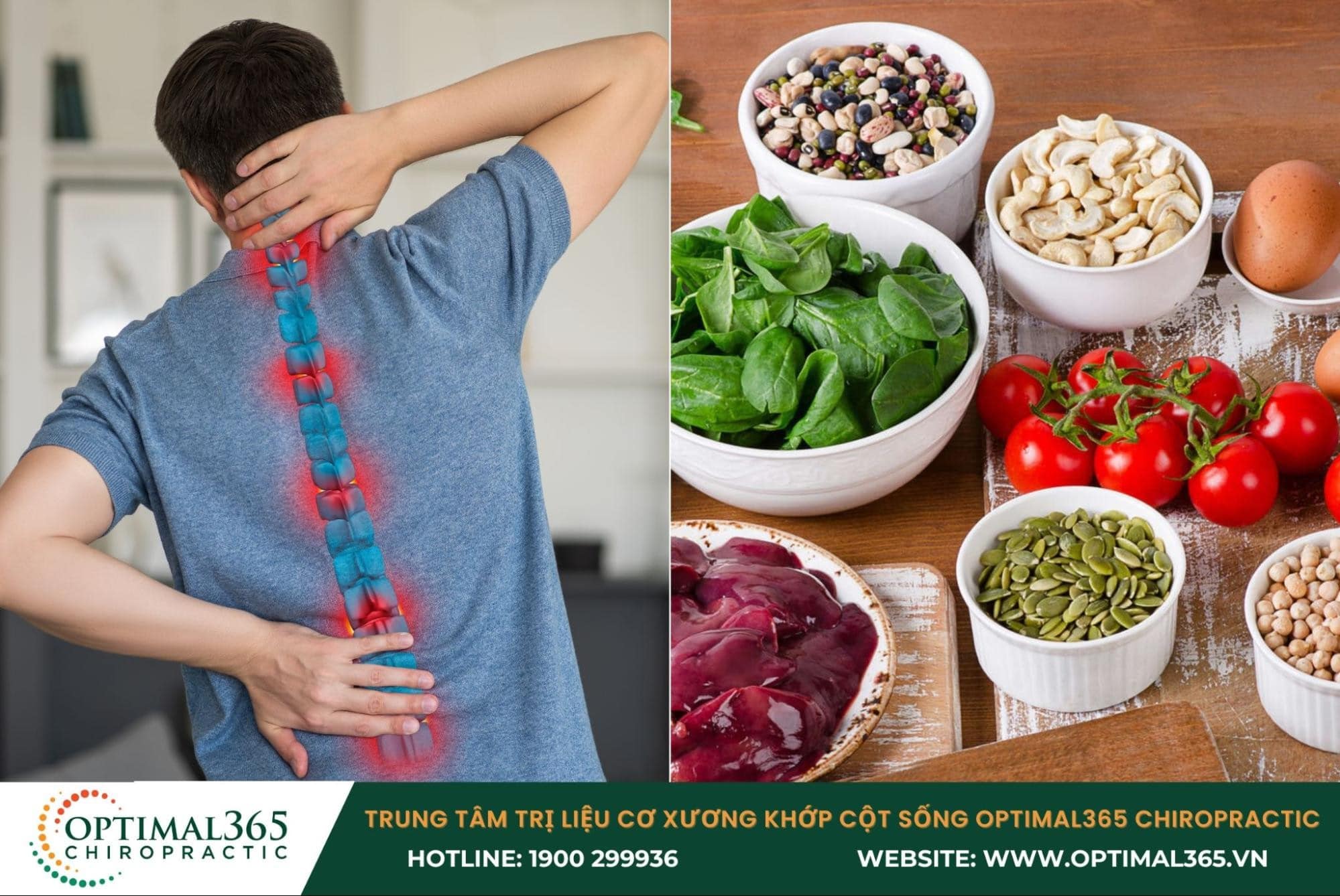 Vai trò của dinh dưỡng trong điều trị và ngăn ngừa gai cột sống