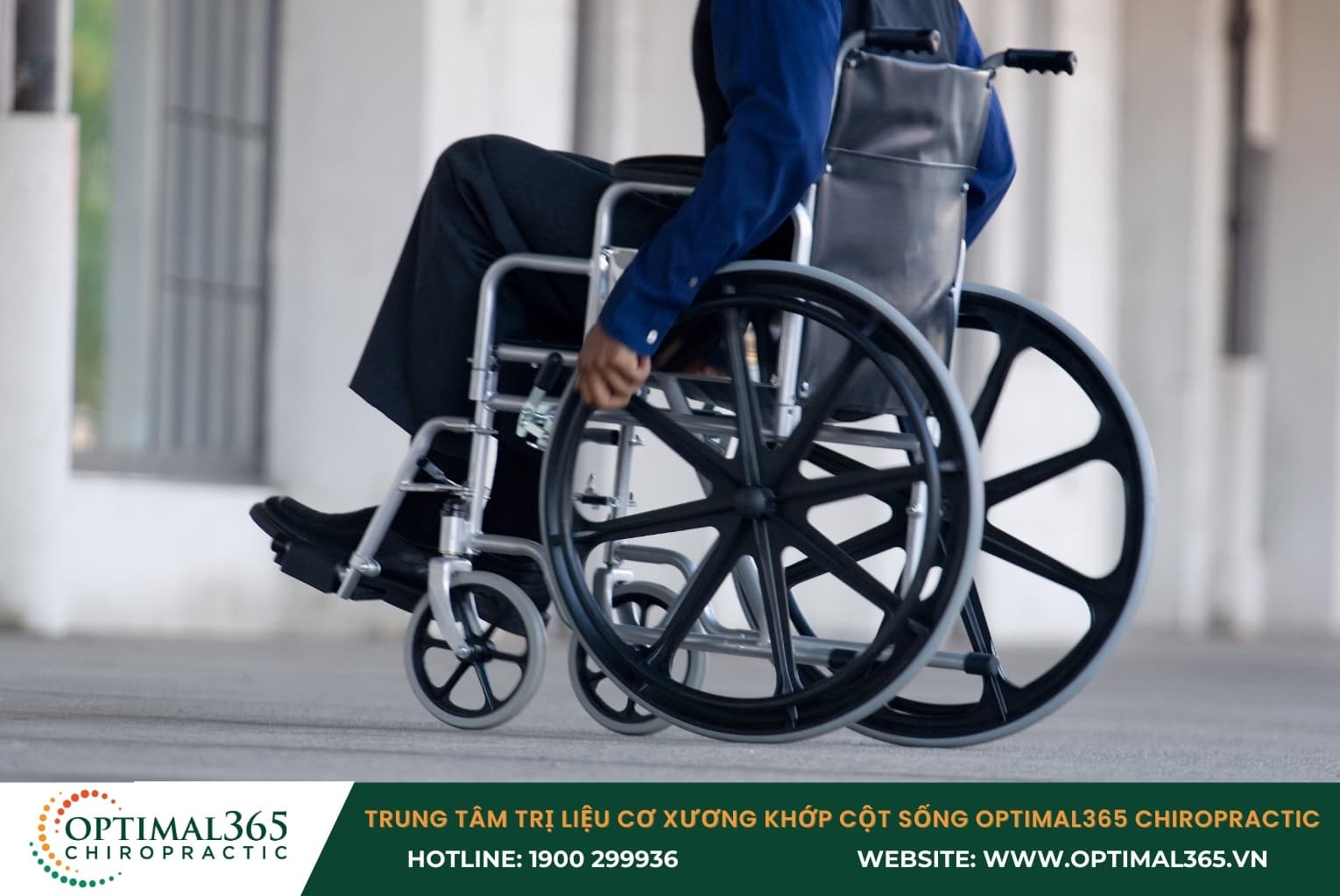 Hemiplegia/Complete Paralysis is the most severe complication of herniated discs.