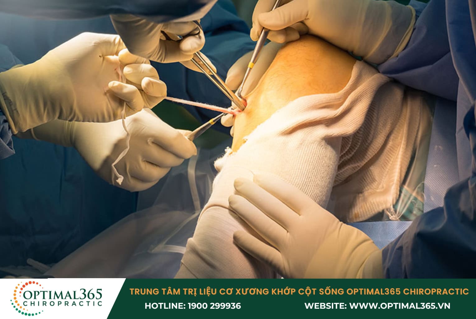 Điều trị phẫu thuật chấn thương dây chằng đầu gối 