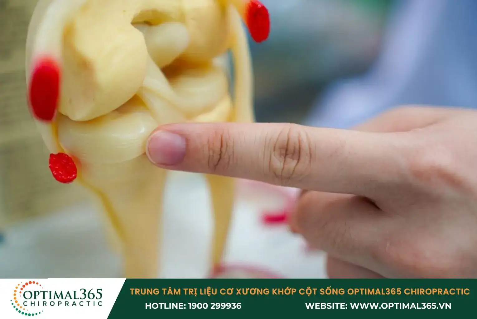 A meniscus tear leads to sharp pain and swelling in the knee joint