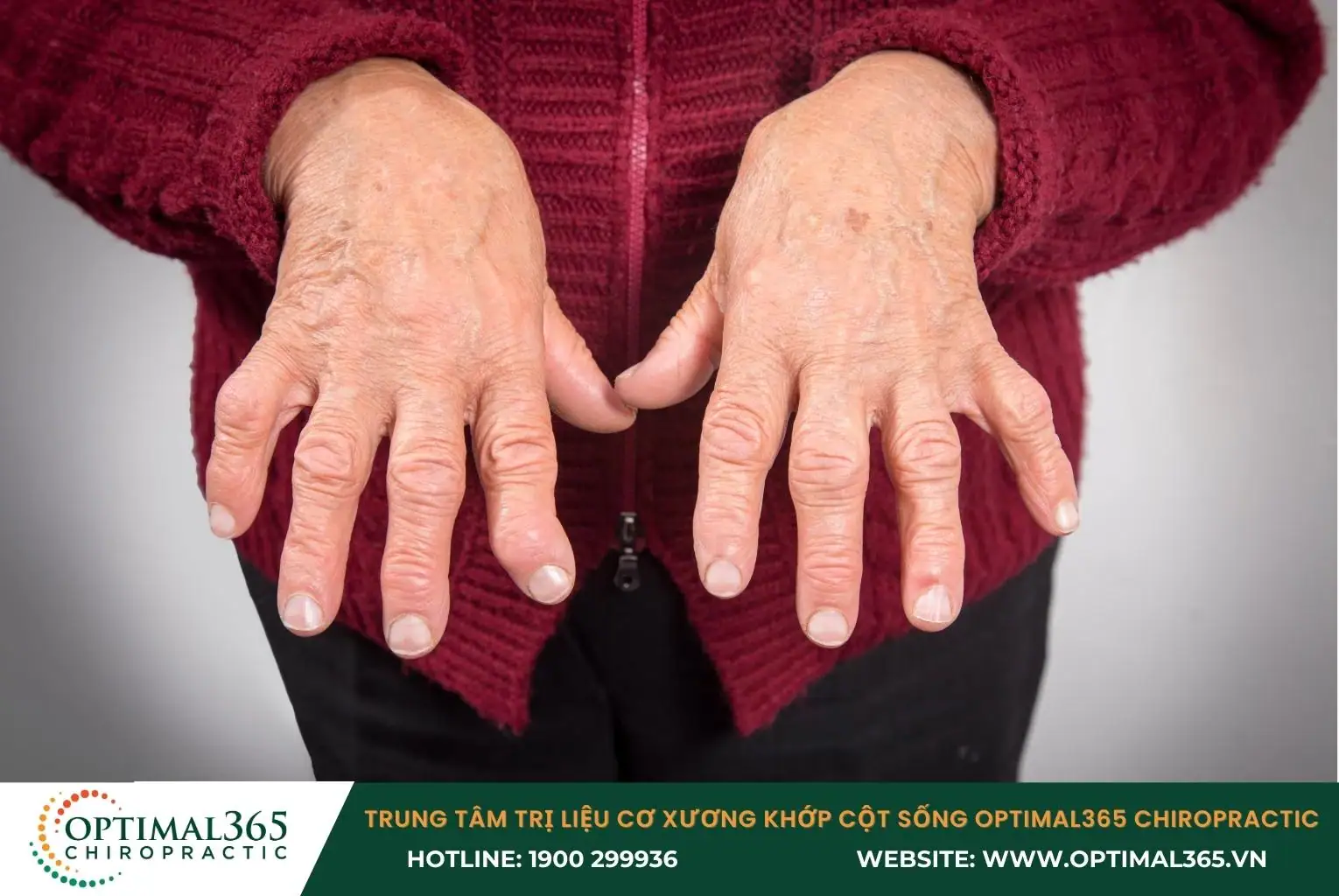 Viêm khớp dạng thấp làm tổn thương các khớp, gây đau nhức khó chịu