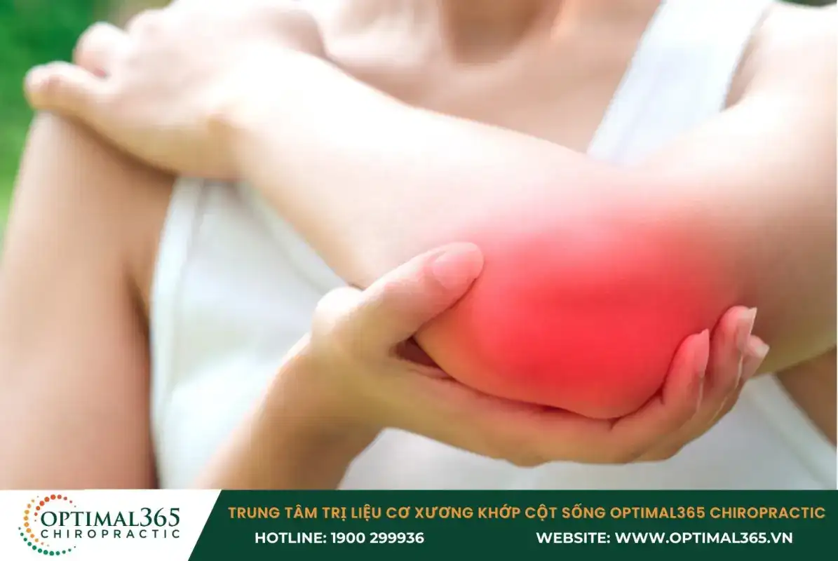 Viêm bao hoạt dịch xảy ra do khớp bị tổn thương