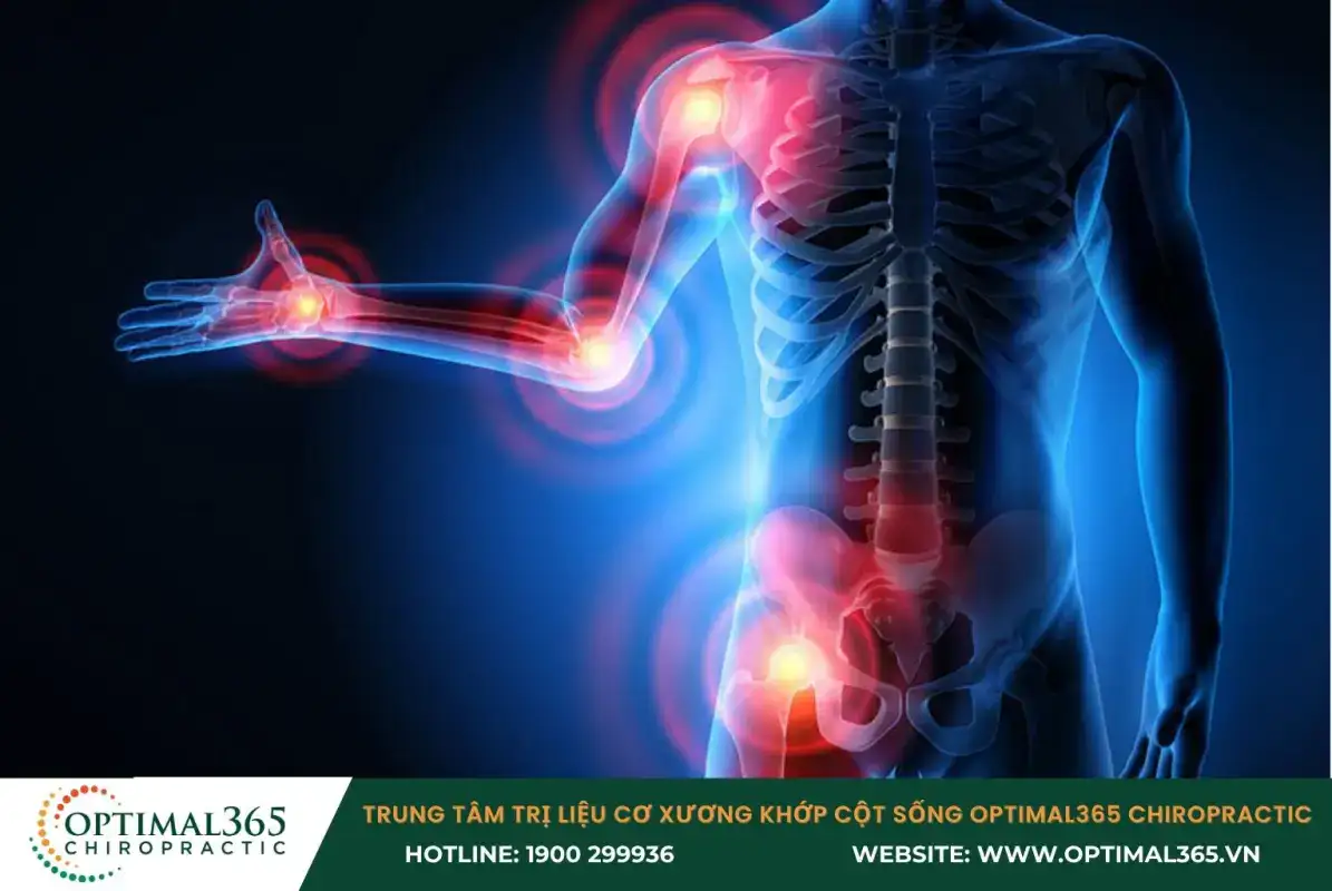 Đau nhức xương khớp toàn thân khi có nhiều vị trí đau cùng lúc