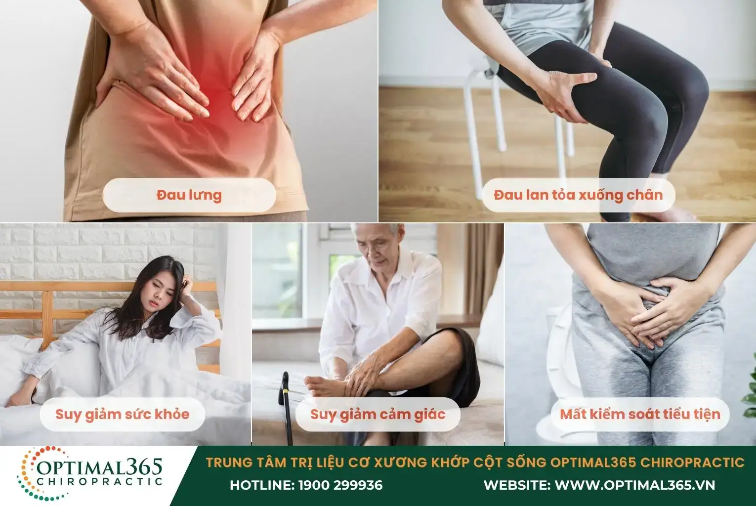 Các triệu chứng của bệnh gai cột sống L4 L5