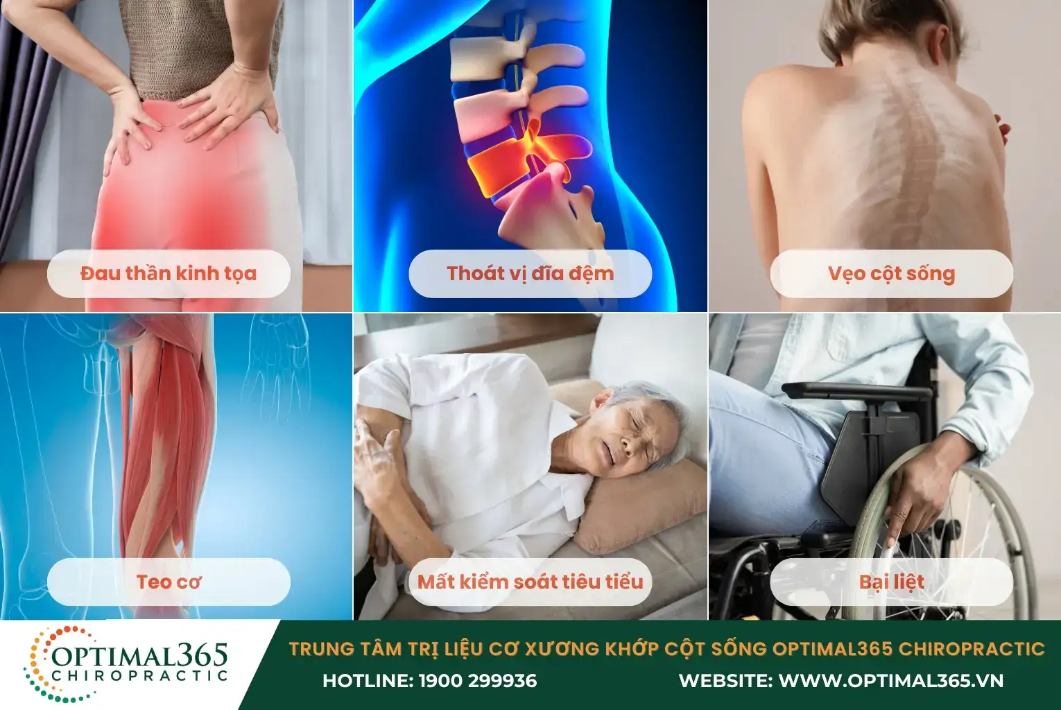 Những biến chứng nguy hiểm của gai cột sống L4 L5