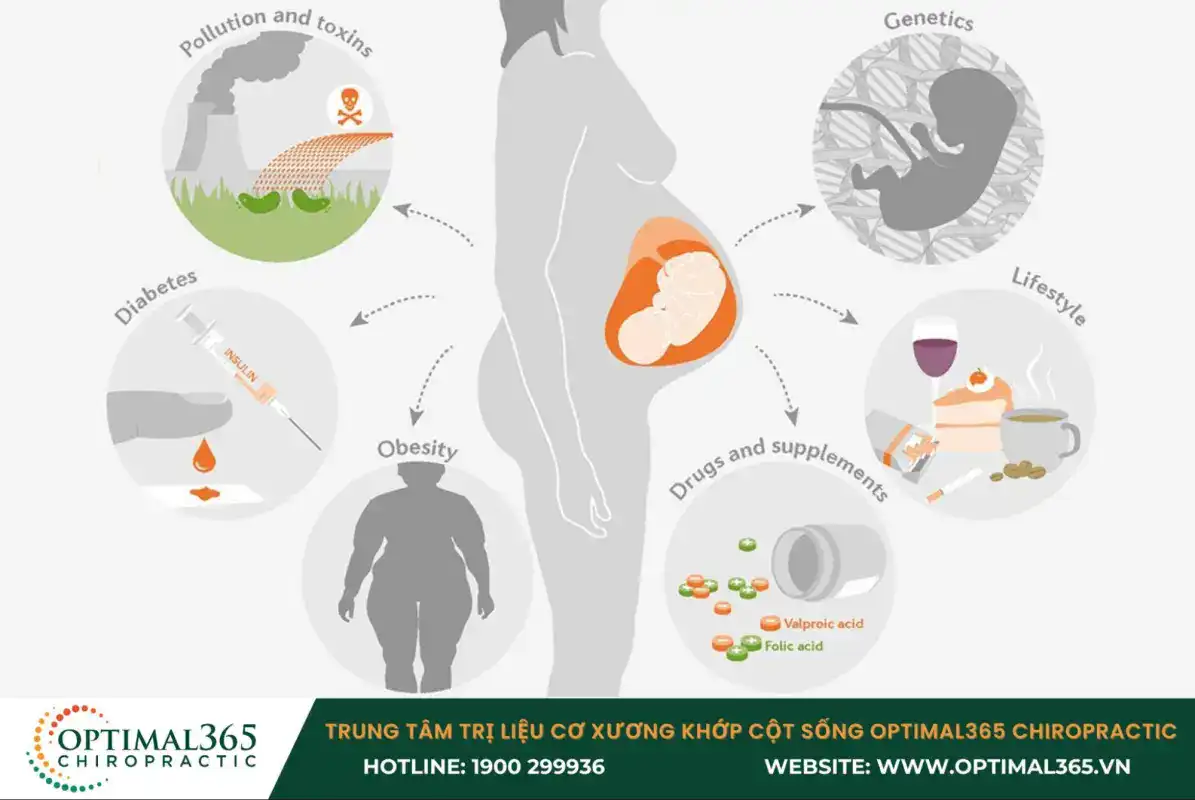 Bệnh gai đôi cột sống S1 có thể xảy ra trong quá trình thai nhi phát triển