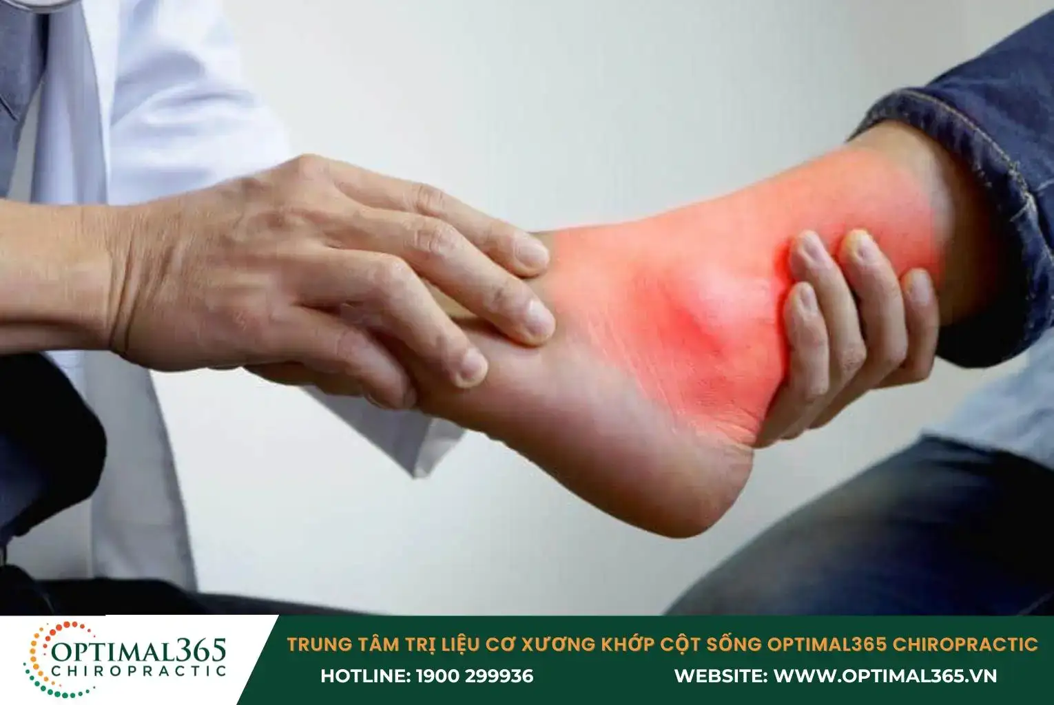 Bong gân cấp độ 1 thường gây ra cảm giác đau không quá dữ dội