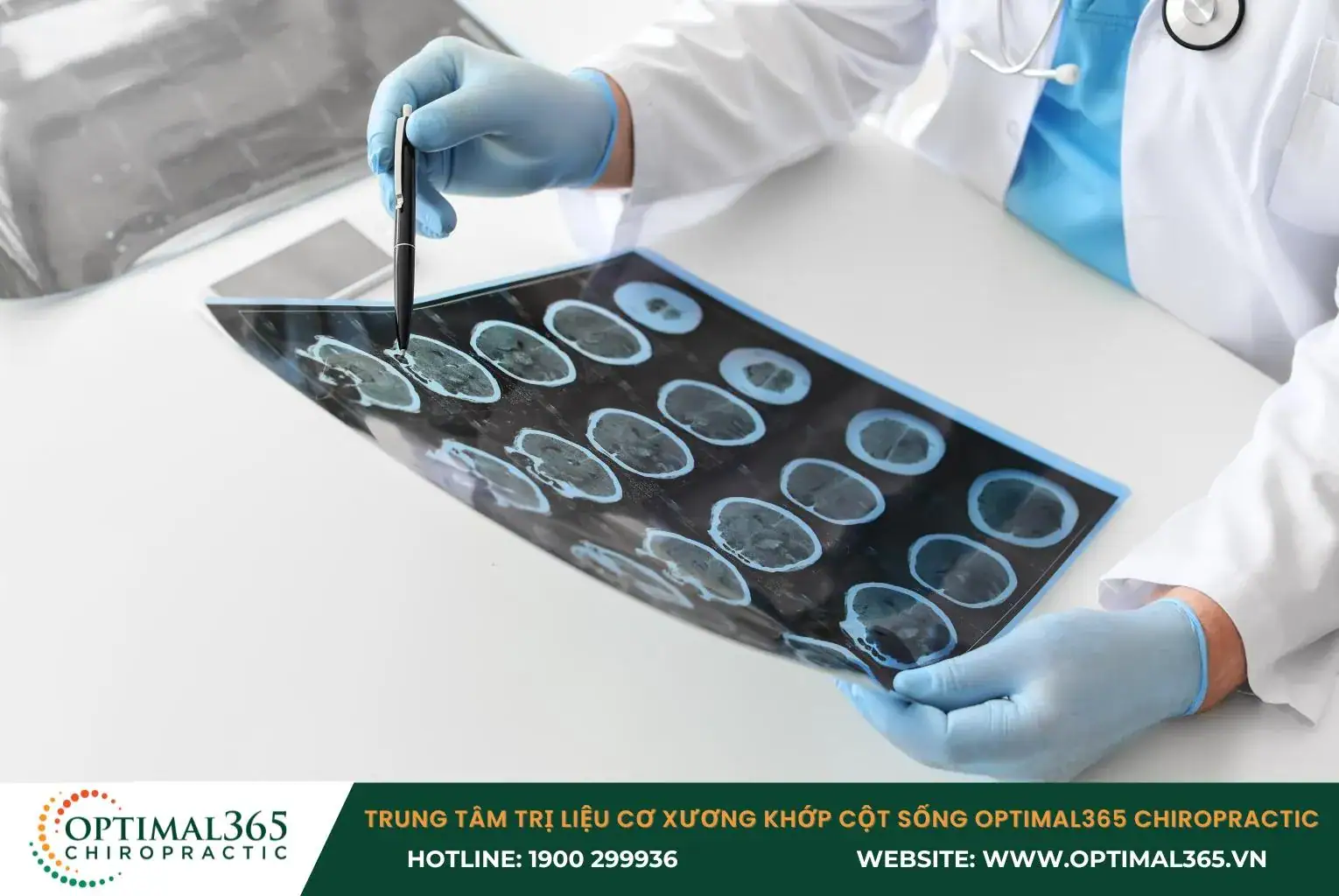 Bác sĩ chẩn đoán nguyên nhân đau nửa đầu qua phim X-quang, CT