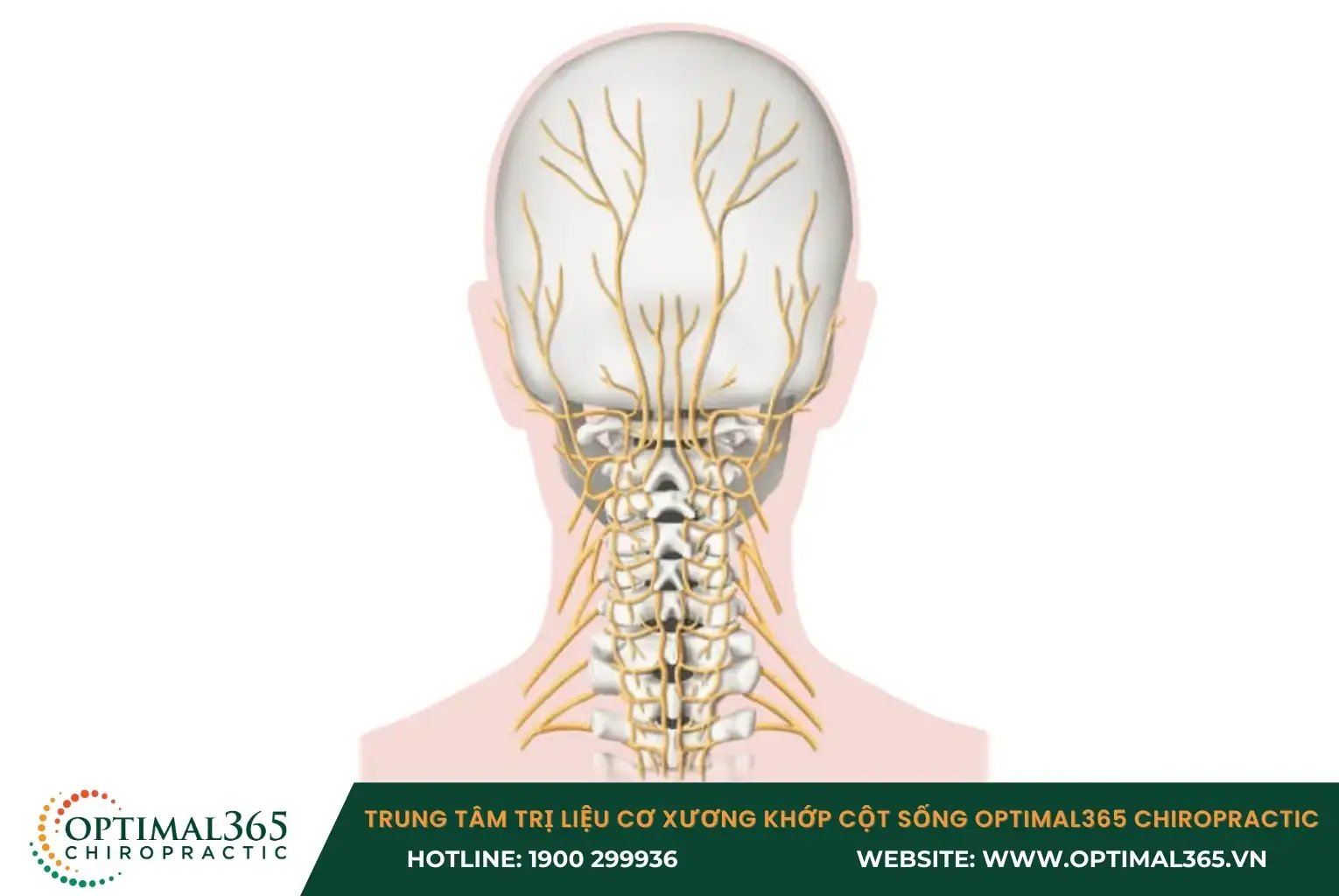 Nguyên nhân thần kinh có thể dẫn đến đau nửa đầu bên phải
