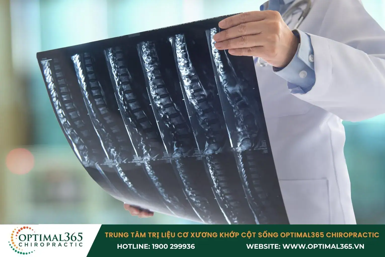 Bác sĩ thăm khám để xác định tình trạng hẹp ống sống