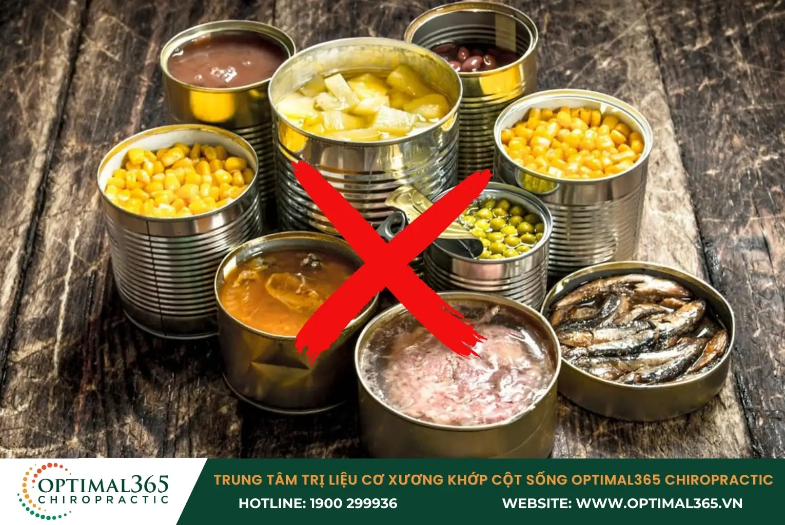 Chất bảo quản trong đồ hộp gây hại cho sức khỏe làm tăng nguy cơ mắc lồi đĩa đệm cột sống cổ