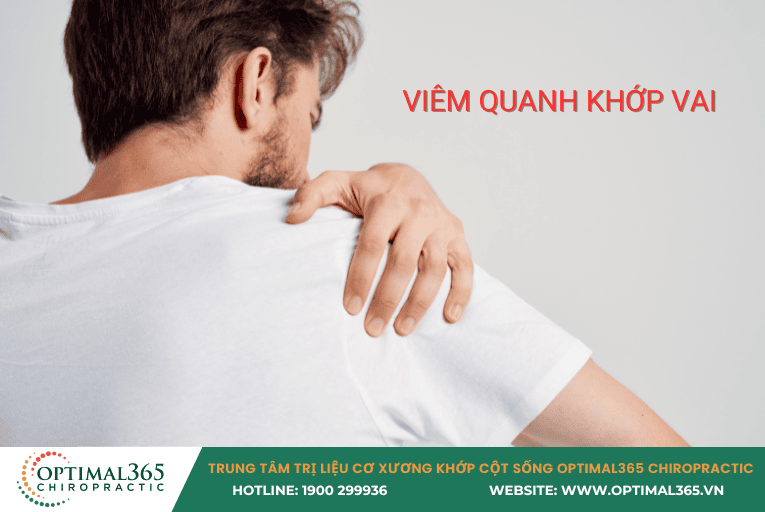  viêm quanh khớp vai