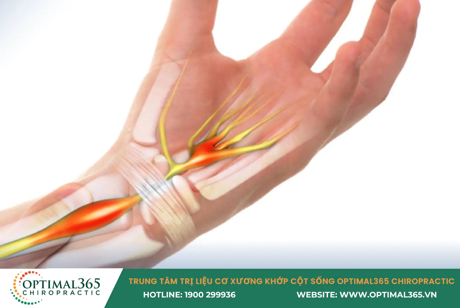 gân và bao gân cổ tay