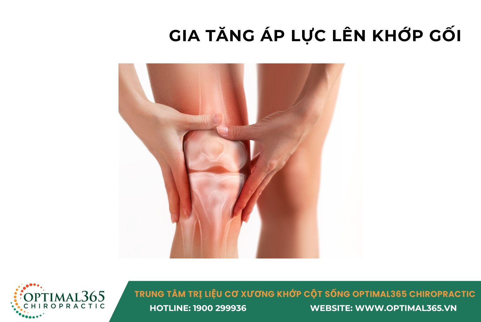 Ảnh hưởng của dáng đi bàn chân bẹt