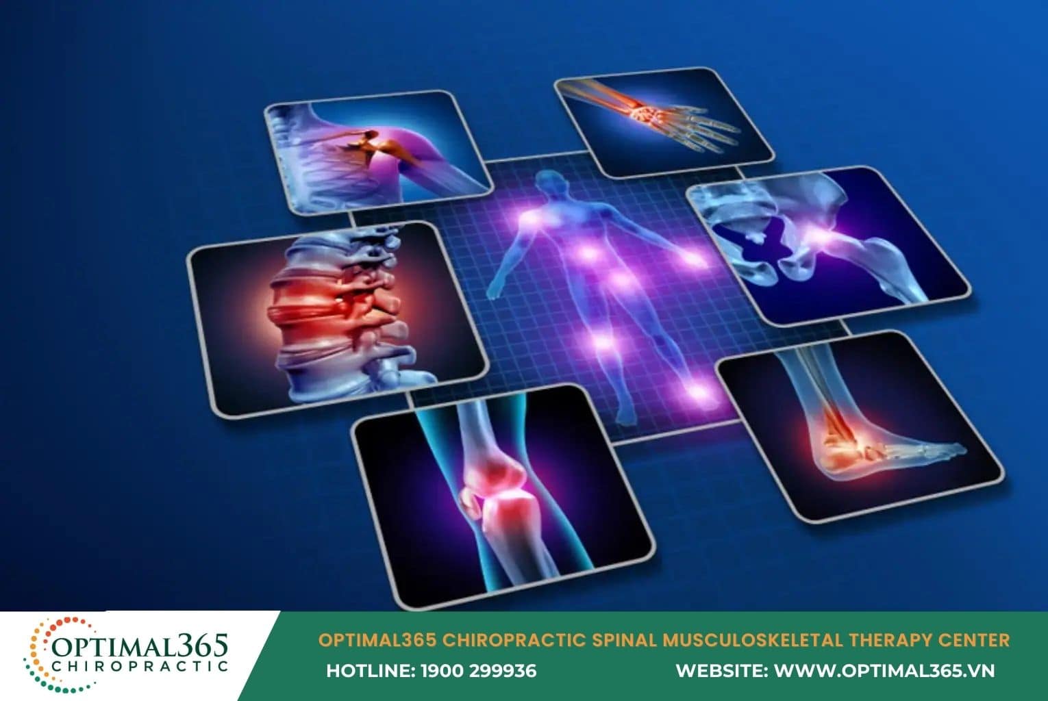 Chiropractic Care for Musculoskeletal Disorders