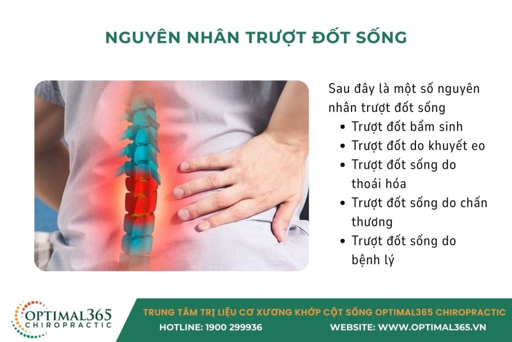 trượt đốt sống