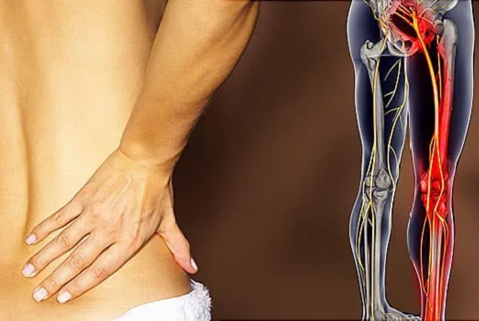 Mô hình so sánh đĩa đệm khỏe mạnh và thoát vị đĩa đệm gây đau lưng tê chân