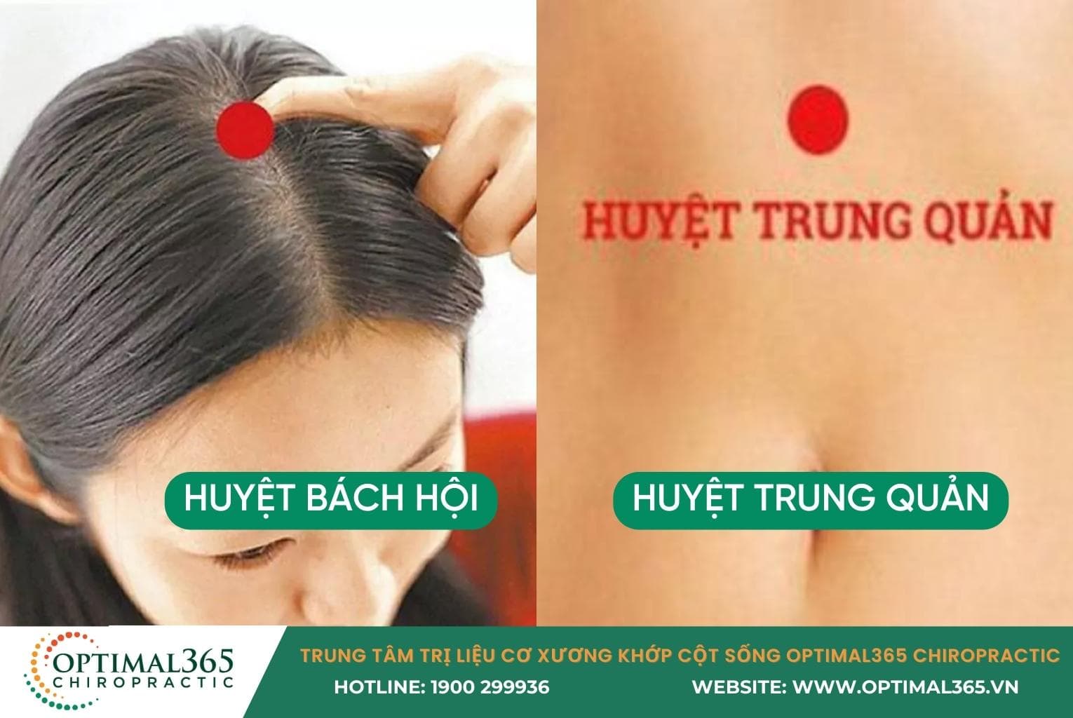 Vị trí huyệt Bách Hội và Trung Quản