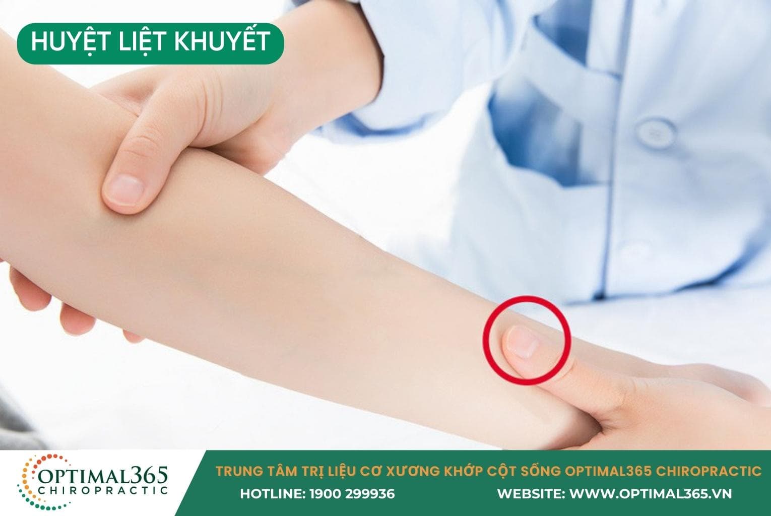 Vị trí huyệt Liệt Khuyết (LU7) cạnh cổ tay.