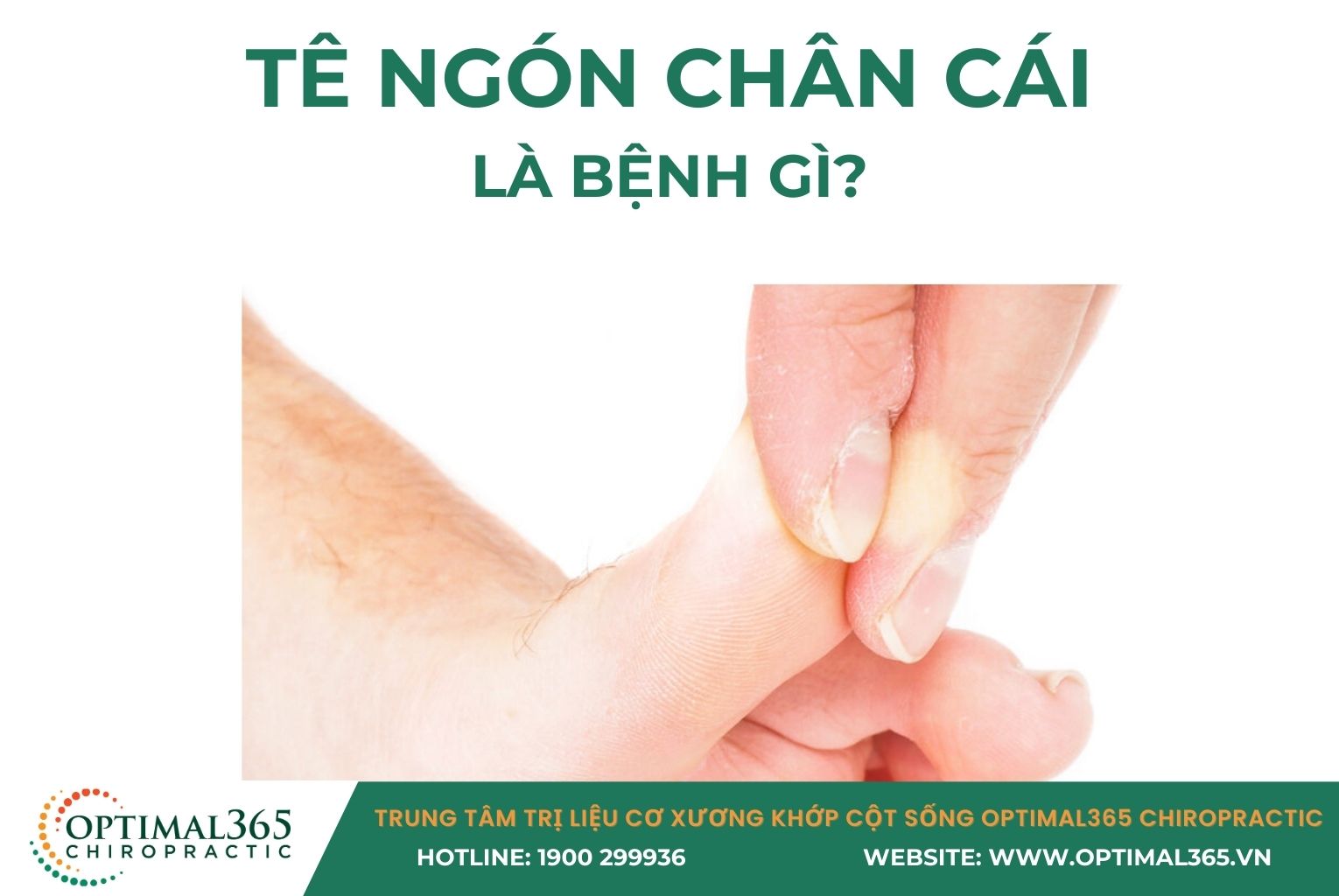 Tê ngón chân cái là bệnh gì