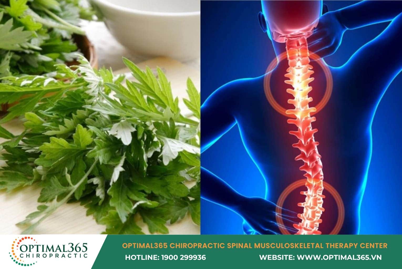 Natural herbs effectively support the treatment of herniated discs