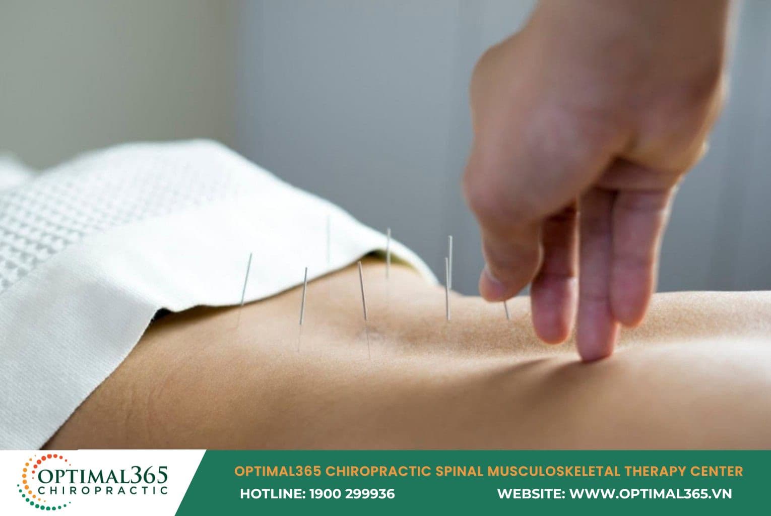 Do not overlook an effective therapy like acupuncture