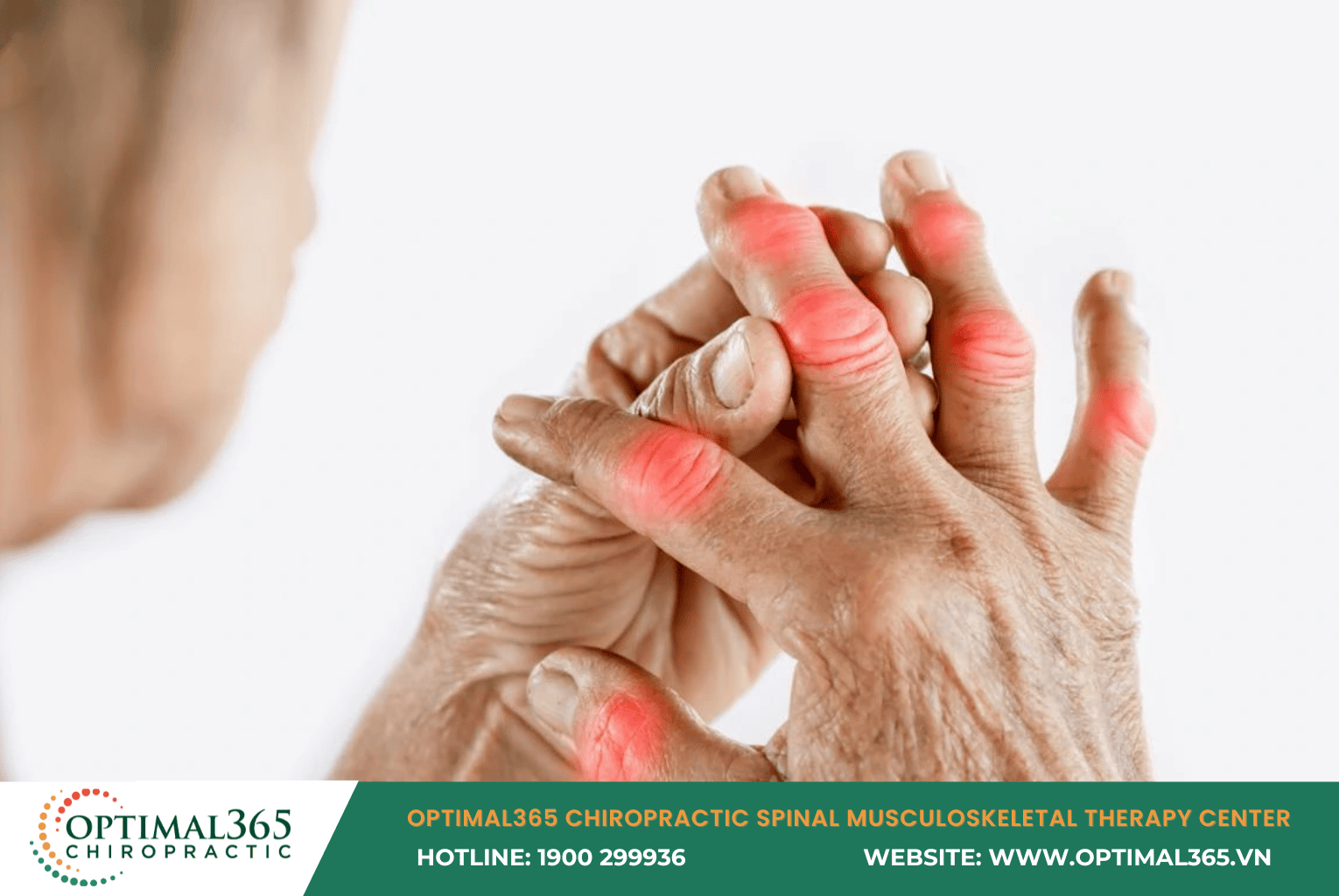 Finger Osteoarthritis