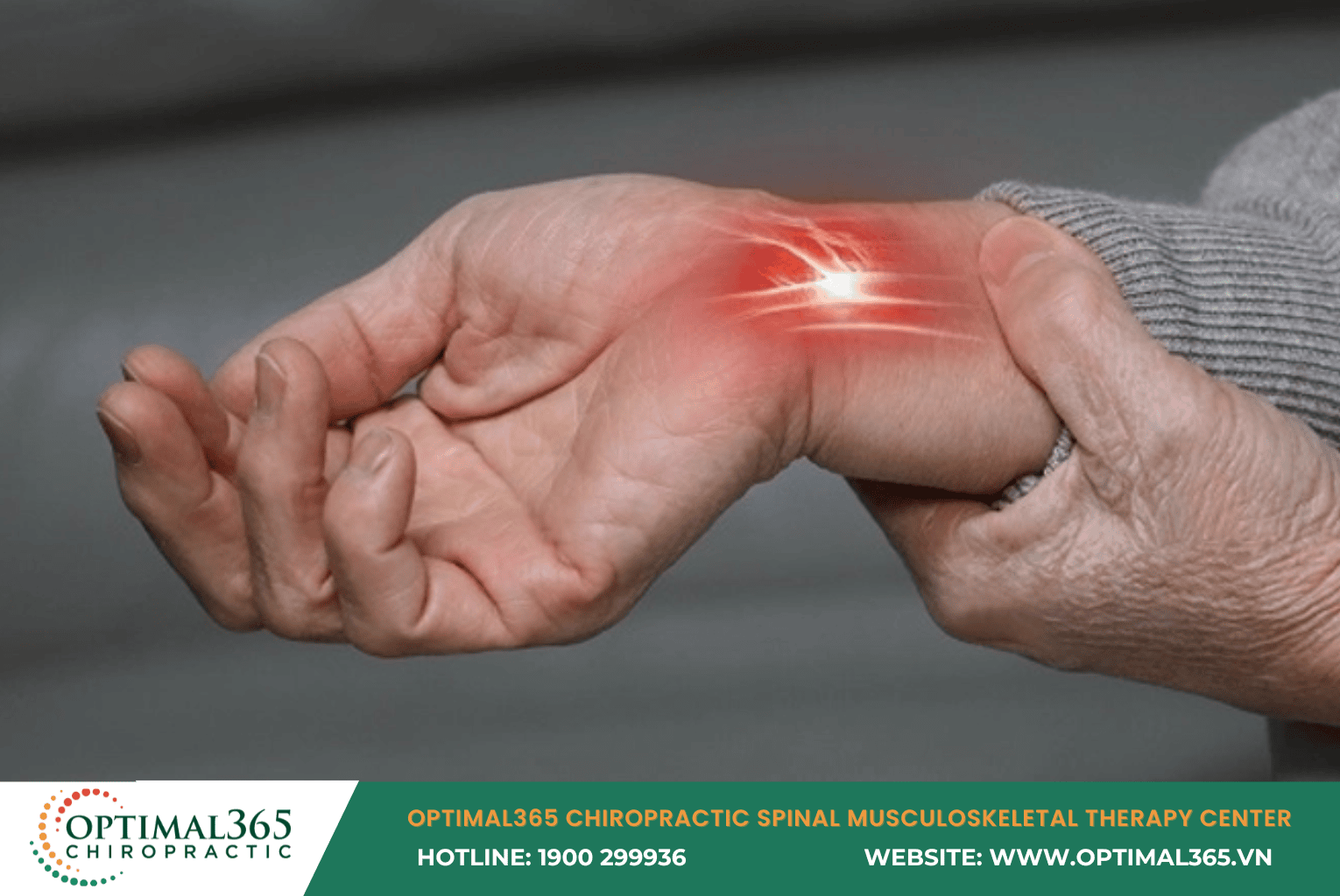 Carpal Tunnel Syndrome (CTS)