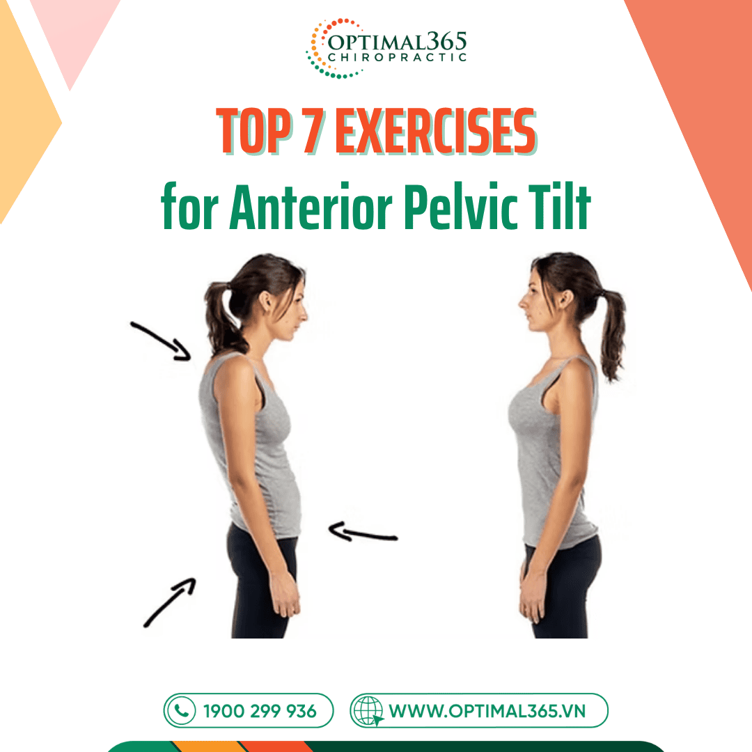 Top 7 Exercises for Anterior Pelvic Tilt to Improve Posture and Spinal Health